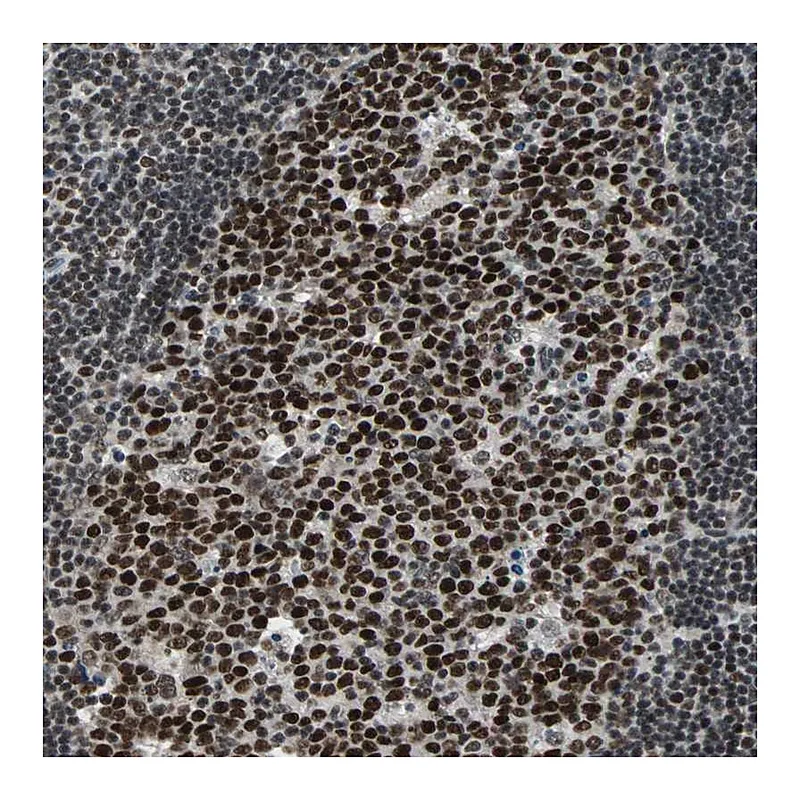 Atlas Antibodies Anti-TERF2IP Antibody