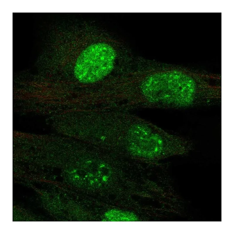 Atlas Antibodies Anti-TERT Antibody