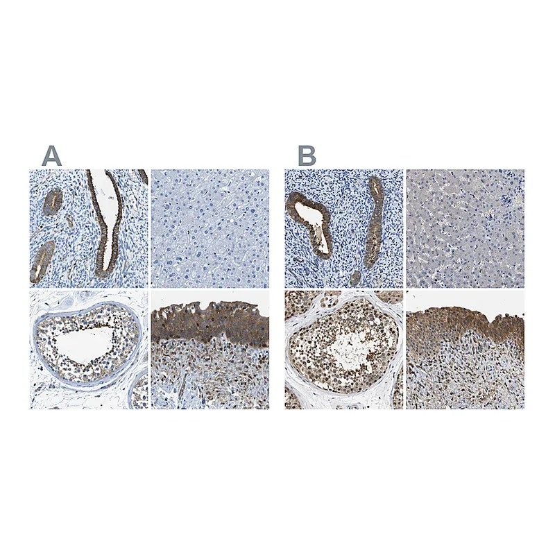 Atlas Antibodies Anti-TES Antibody