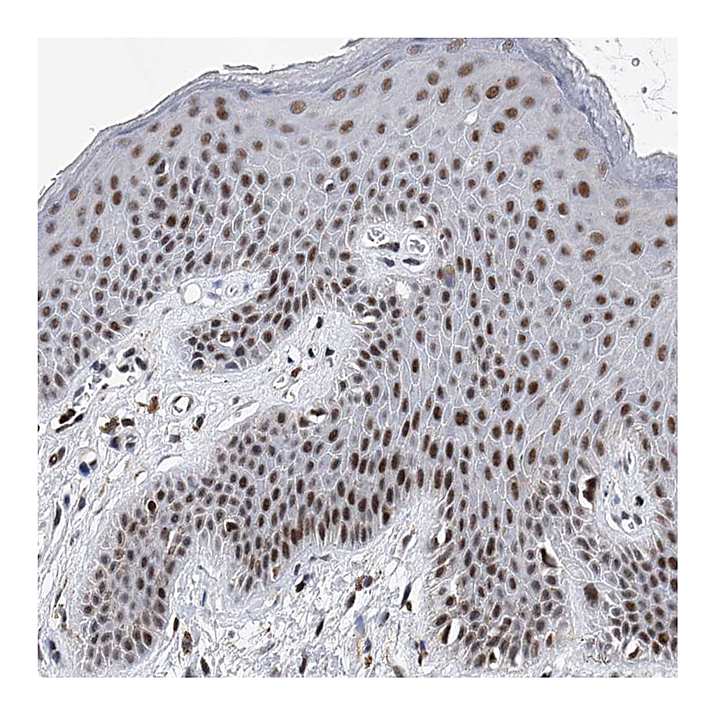 Atlas Antibodies Anti-TESK2 Antibody