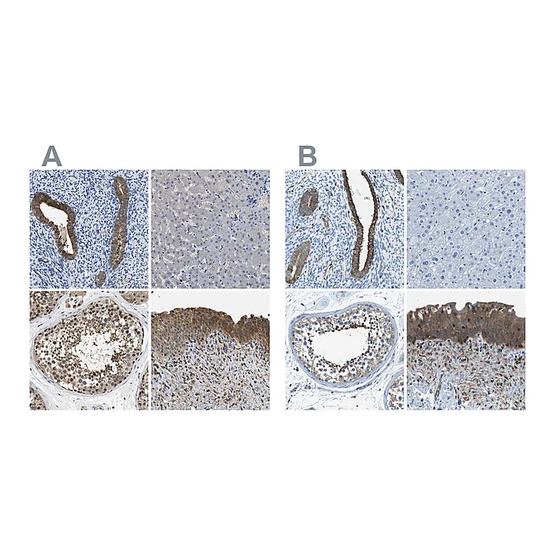 Atlas Antibodies Anti-TES Antibody