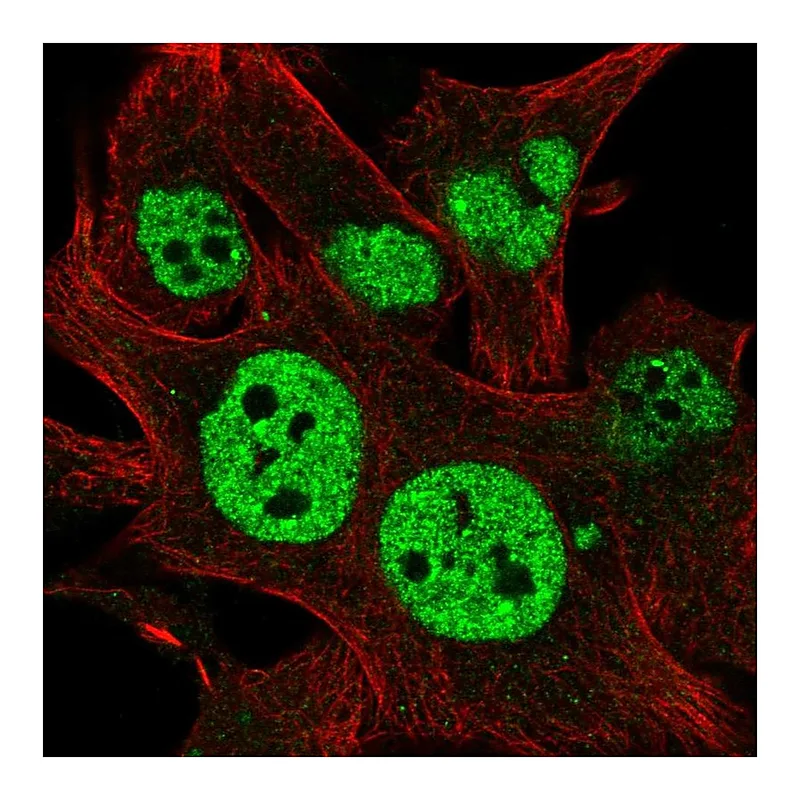 Atlas Antibodies Anti-TESK2 Antibody