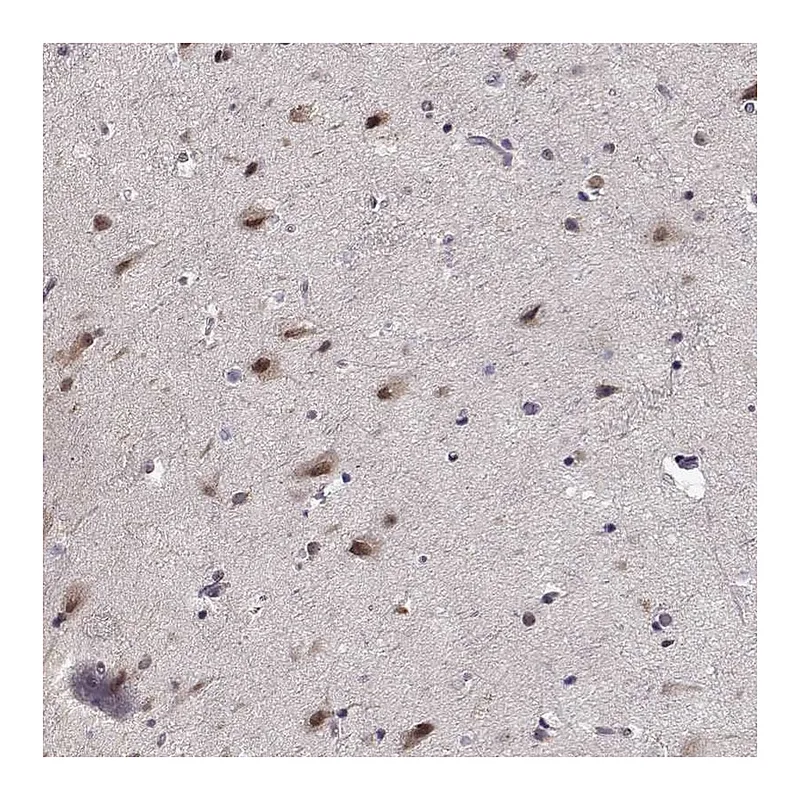 Atlas Antibodies Anti-TESPA1 Antibody