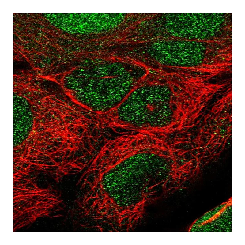 Atlas Antibodies Anti-TET1 Antibody