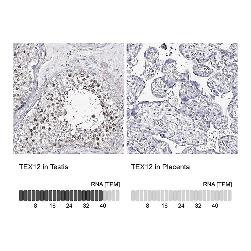 Atlas Antibodies Anti-TEX12 Antibody