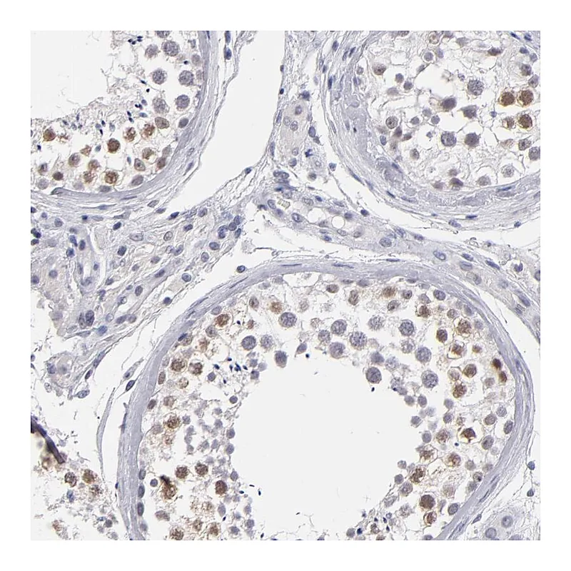 Atlas Antibodies Anti-TEX11 Antibody