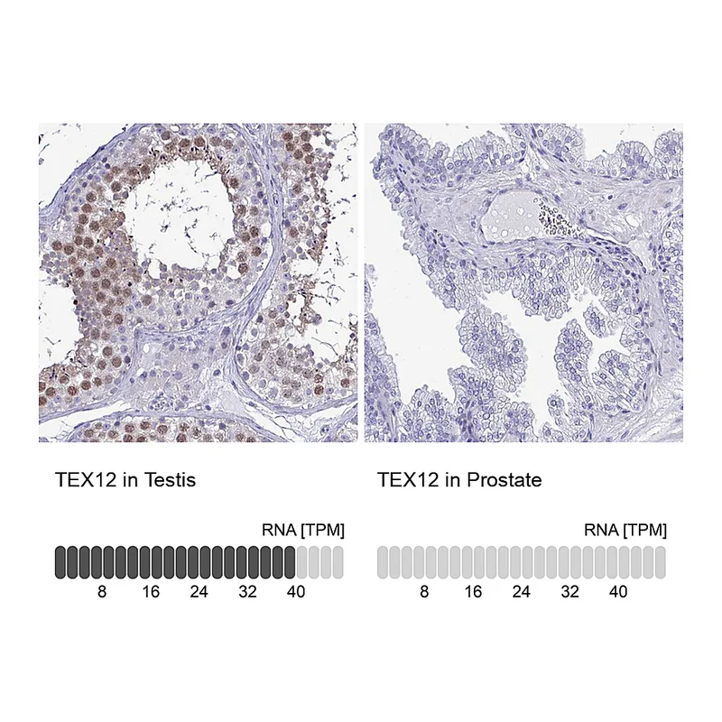 Atlas Antibodies Anti-TEX12 Antibody