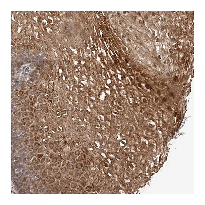 Atlas Antibodies Anti-TEX13B Antibody