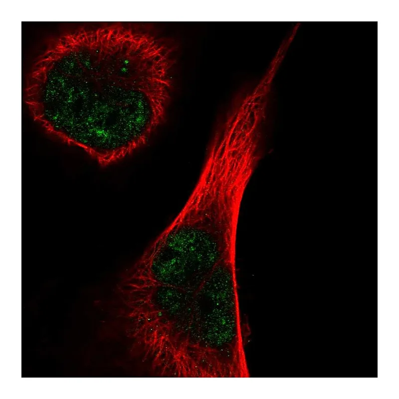 Atlas Antibodies Anti-TEX15 Antibody