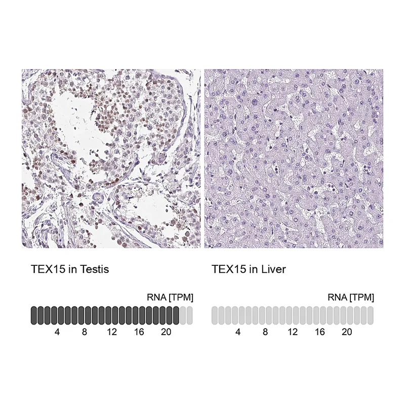 Atlas Antibodies Anti-TEX15 Antibody