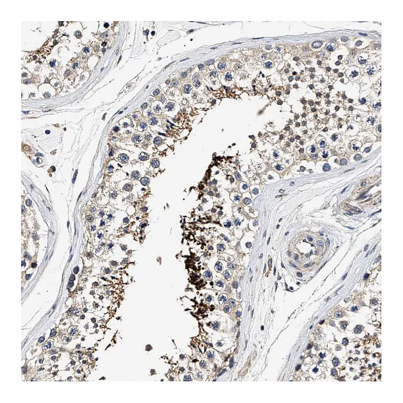 Atlas Antibodies Anti-TEX2 Antibody