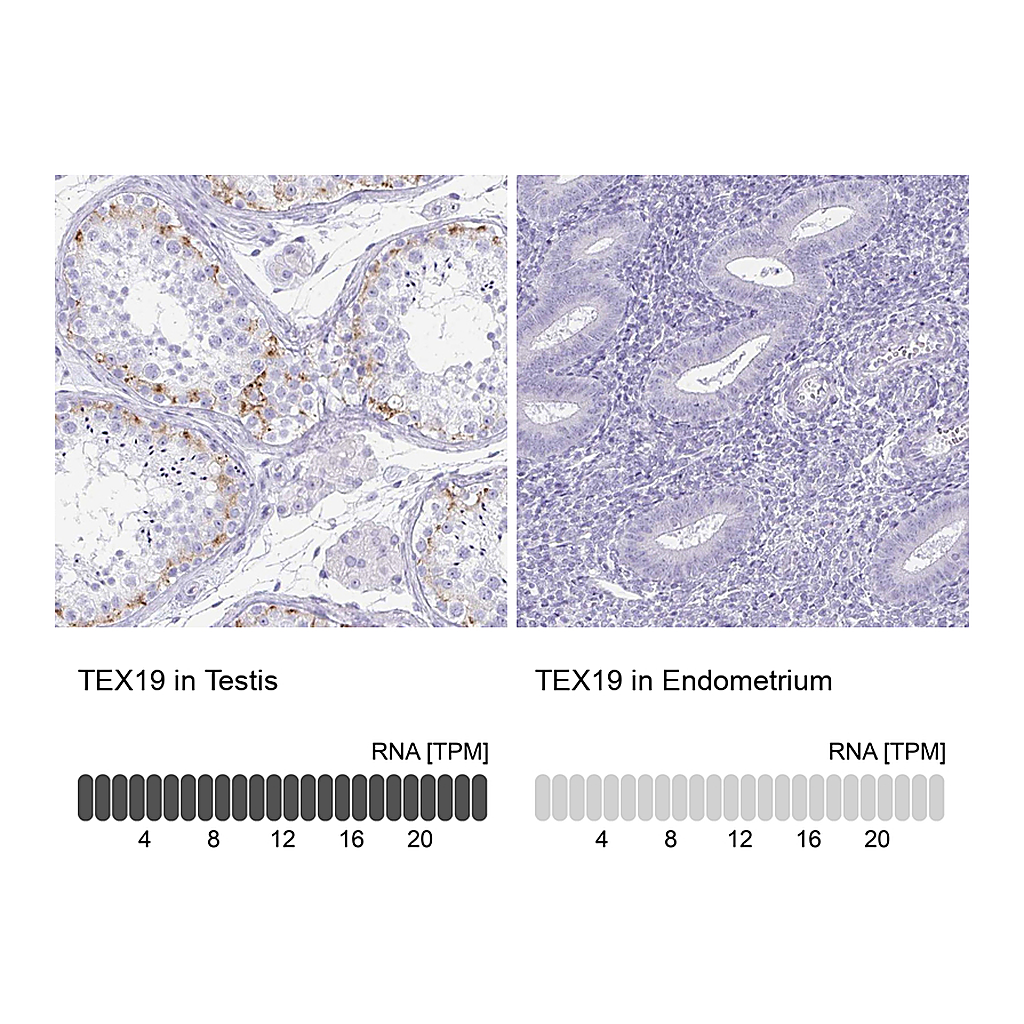 Atlas Antibodies Anti-TEX19 Antibody