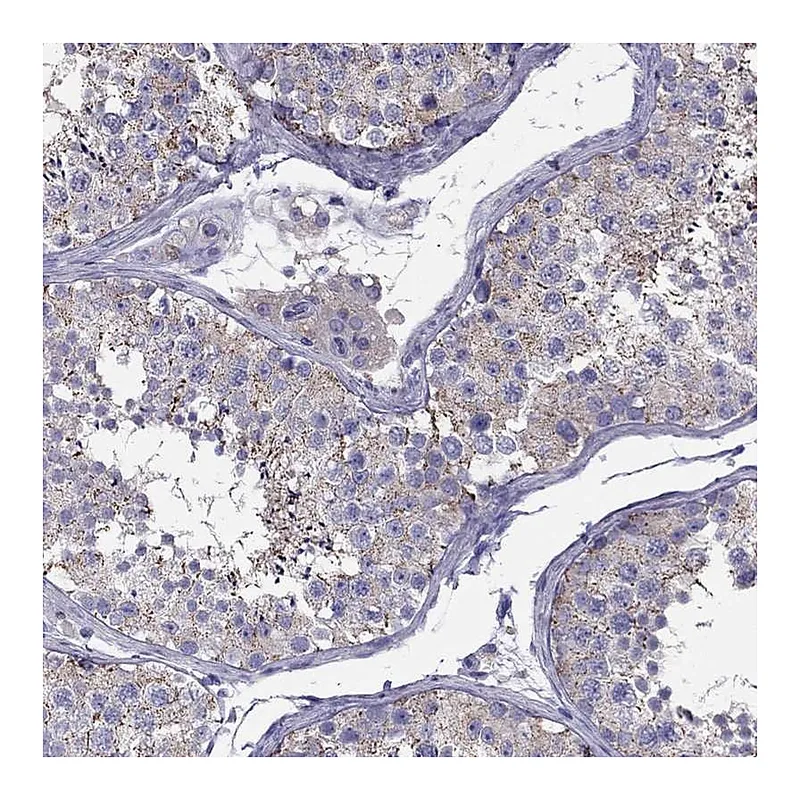 Atlas Antibodies Anti-TEX22 Antibody