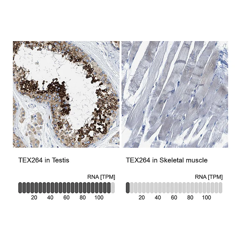 Atlas Antibodies Anti-TEX264 Antibody