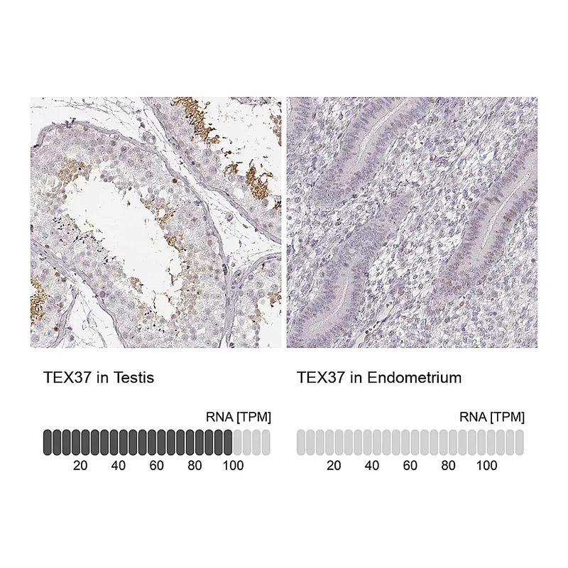 Atlas Antibodies Anti-TEX37 Antibody