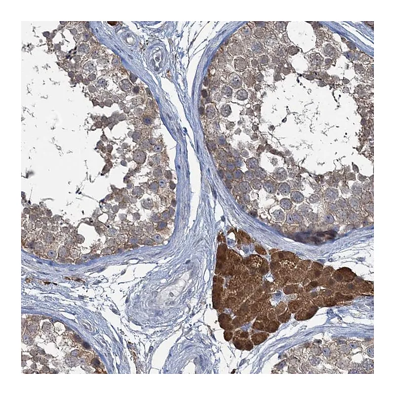 Atlas Antibodies Anti-TEX35 Antibody