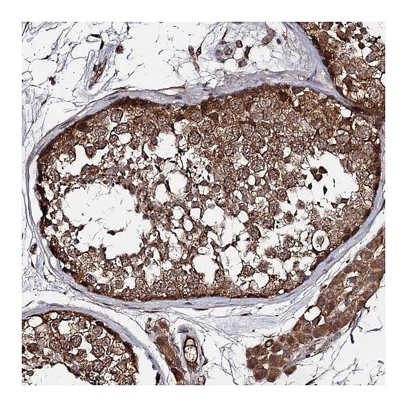 Atlas Antibodies Anti-TEX9 Antibody