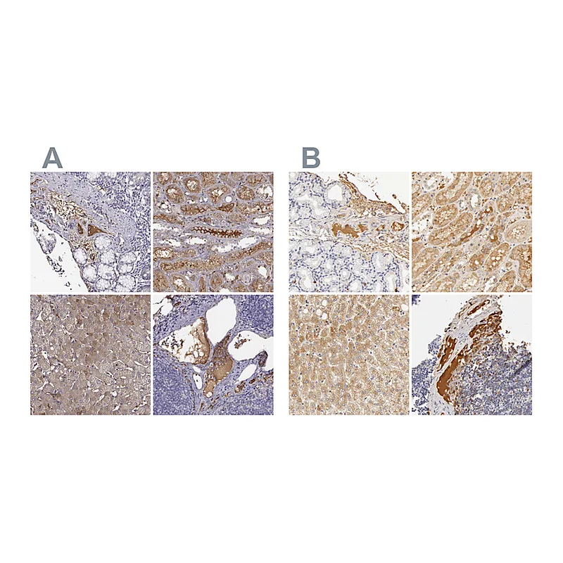 Atlas Antibodies Anti-TF Antibody