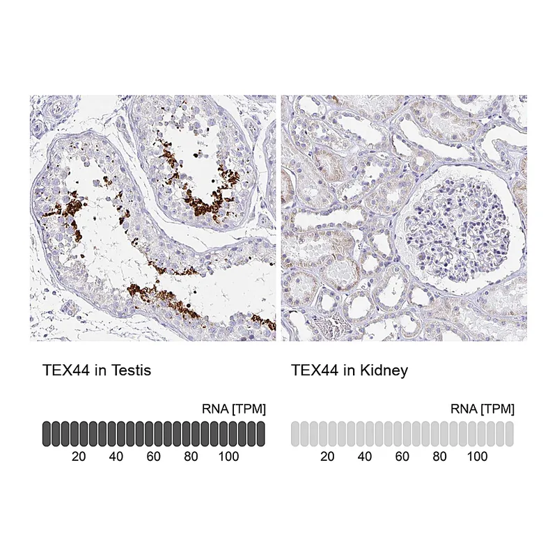 Atlas Antibodies Anti-TEX44 Antibody