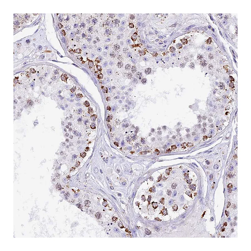 Atlas Antibodies Anti-TFAM Antibody