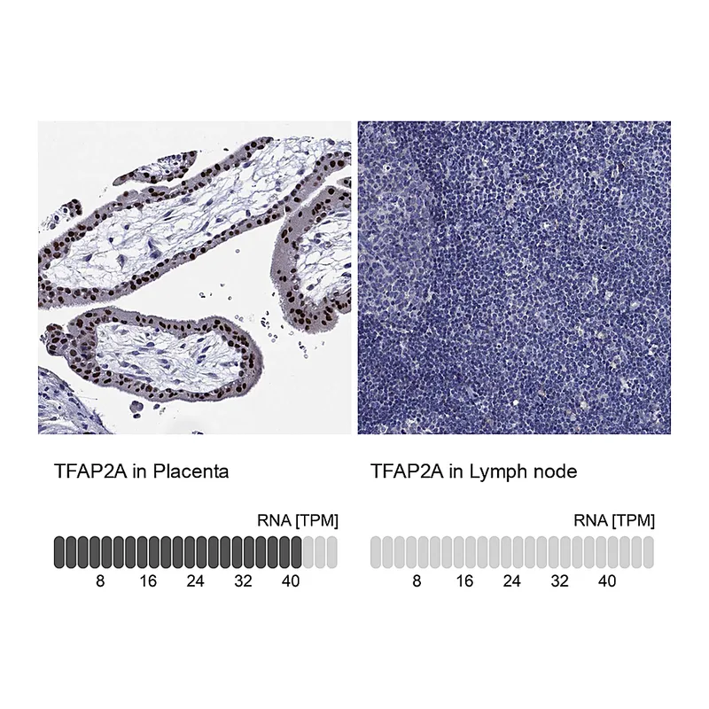 Atlas Antibodies Anti-TFAP2A Antibody
