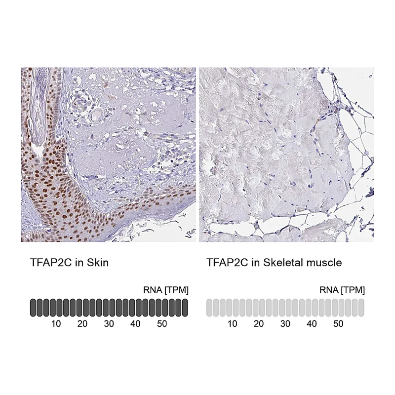 Atlas Antibodies Anti-TFAP2C Antibody