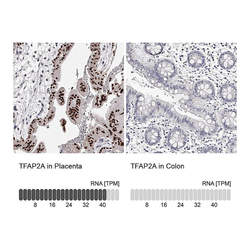 Atlas Antibodies Anti-TFAP2A Antibody