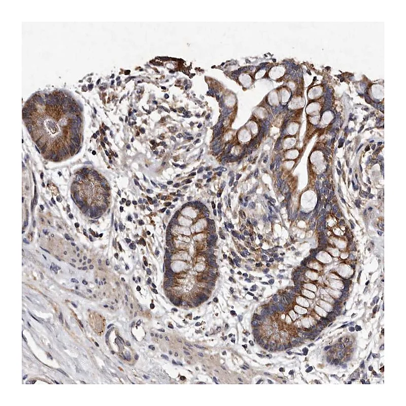 Atlas Antibodies Anti-TFB1M Antibody