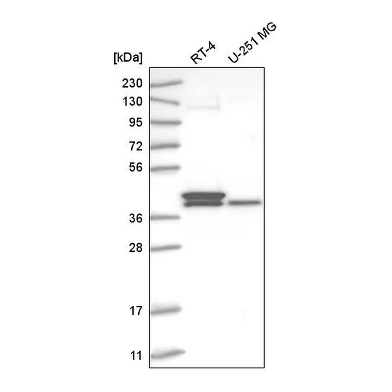 Atlas Antibodies Anti-TFB2M Antibody