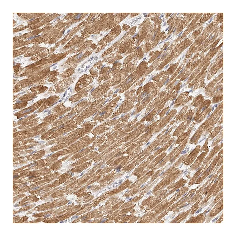 Atlas Antibodies Anti-TFB2M Antibody
