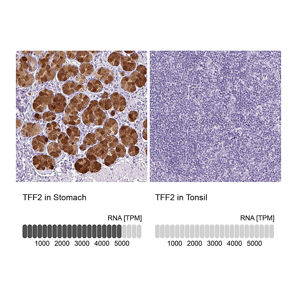 Atlas Antibodies Anti-TFF2 Antibody