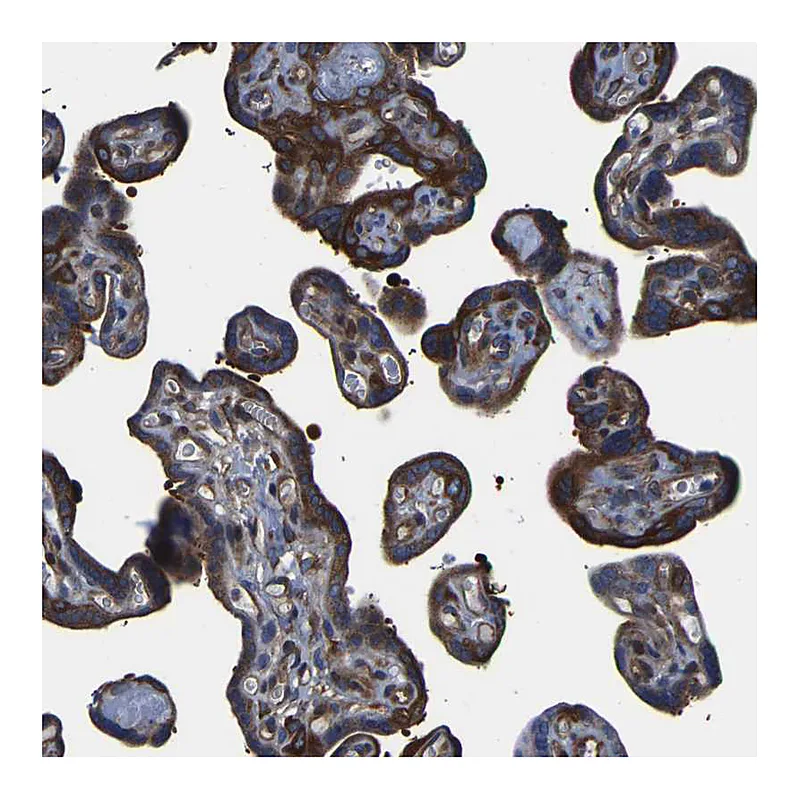 Atlas Antibodies Anti-TFG Antibody