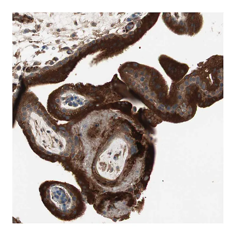 Atlas Antibodies Anti-TFPI Antibody