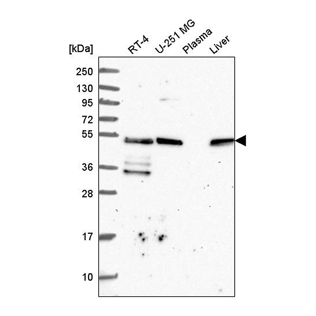 Atlas Antibodies Anti-TFG Antibody