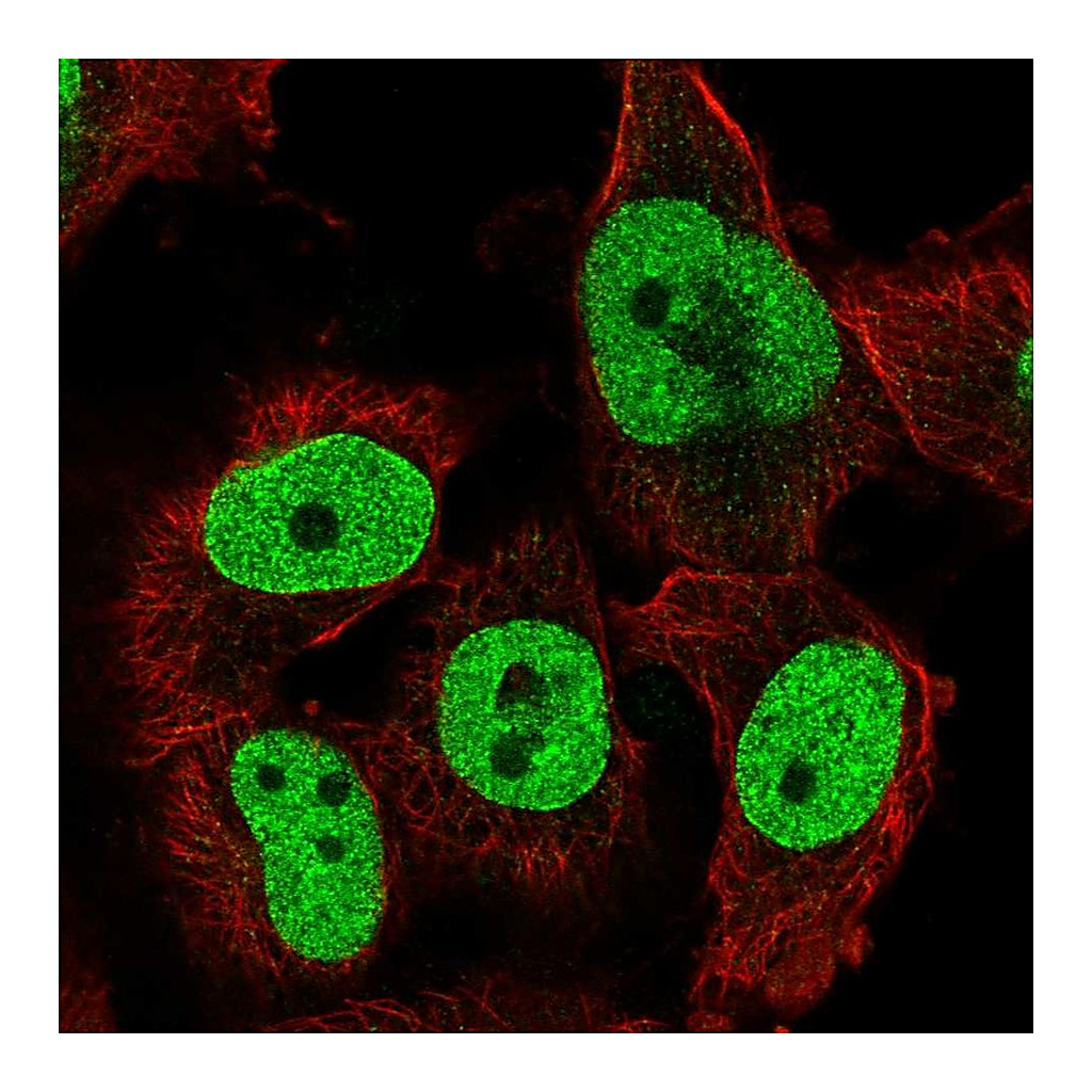 Atlas Antibodies Anti-TFPT Antibody