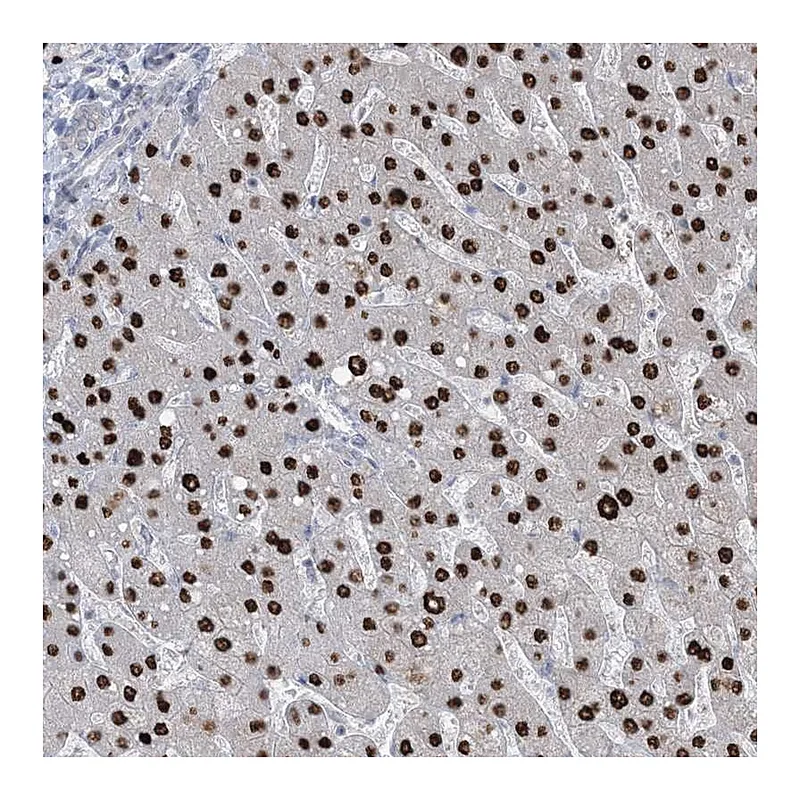 Atlas Antibodies Anti-TFPT Antibody