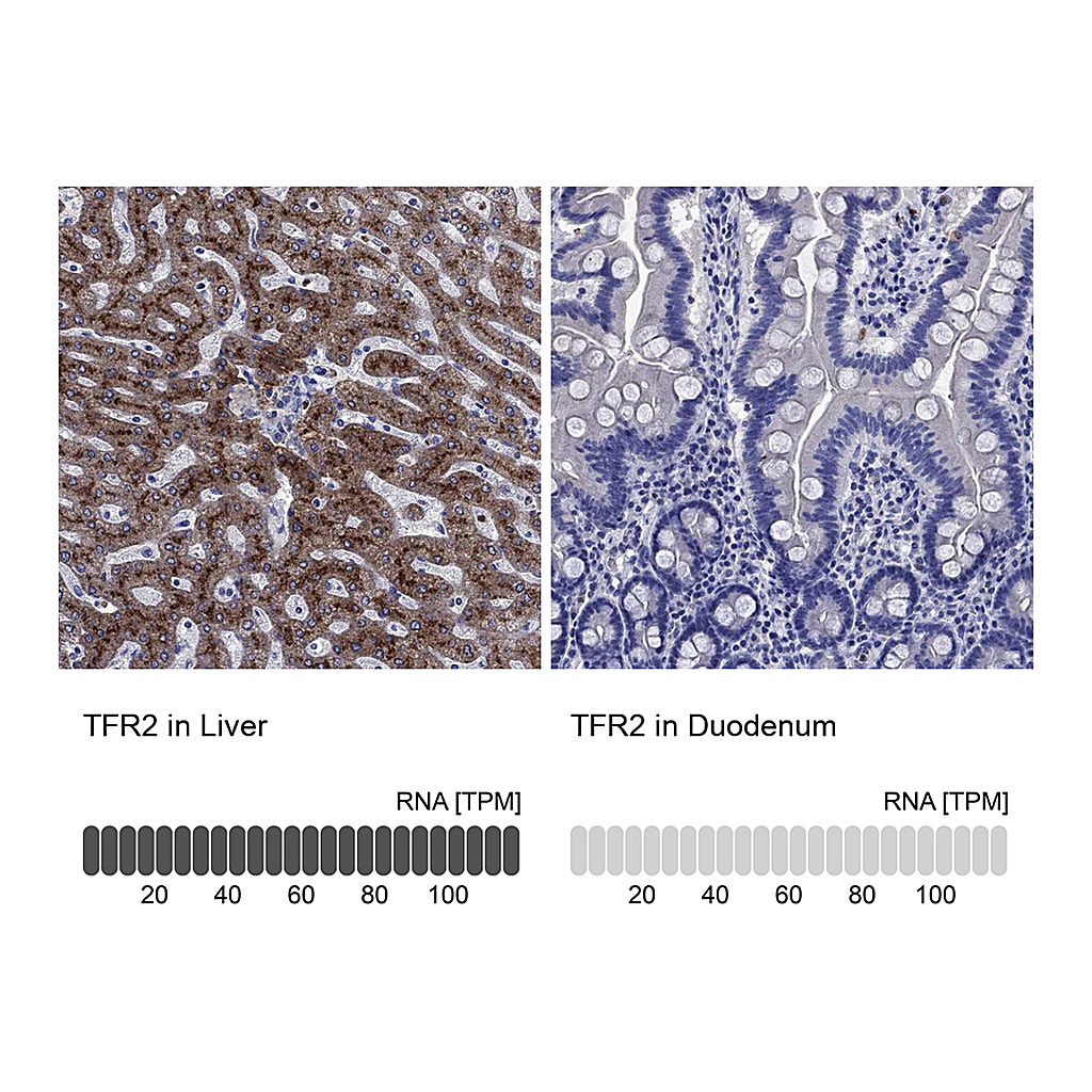 Atlas Antibodies Anti-TFR2 Antibody