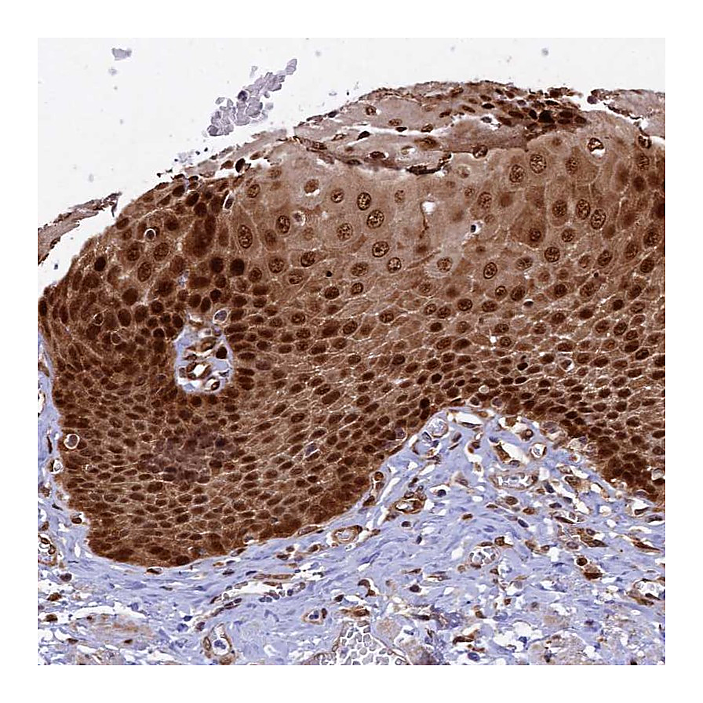 Atlas Antibodies Anti-TGDS Antibody