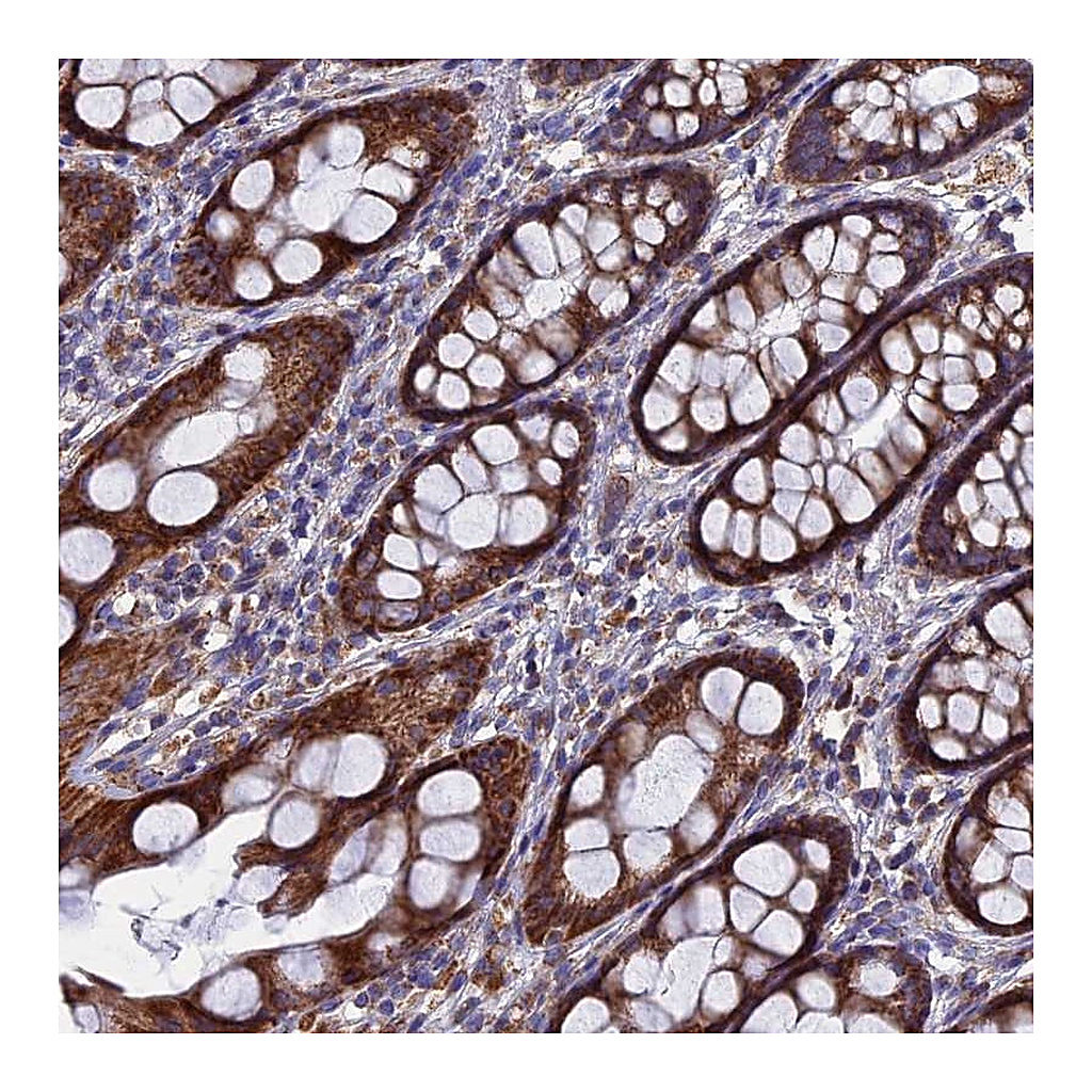 Atlas Antibodies Anti-TGFA Antibody