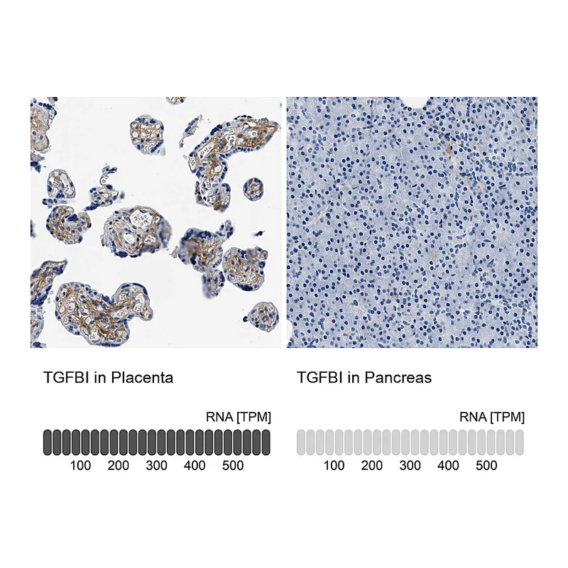 Atlas Antibodies Anti-TGFBI Antibody