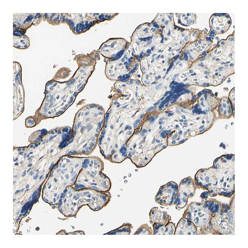 Atlas Antibodies Anti-TGFBR3 Antibody