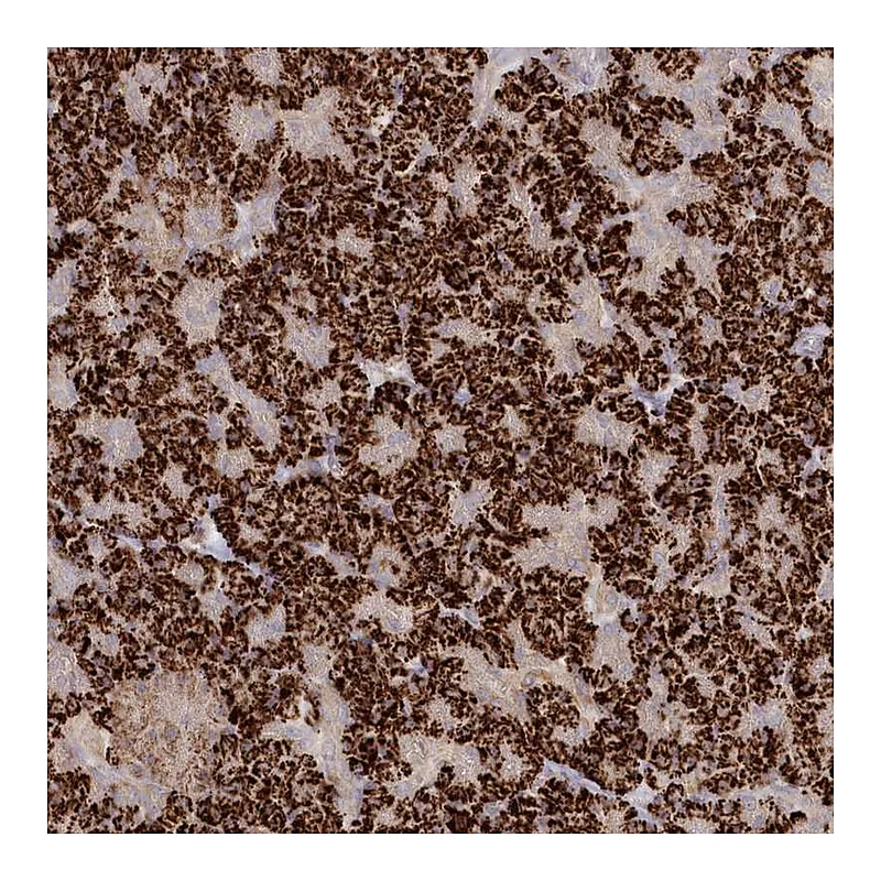 Atlas Antibodies Anti-TGFBRAP1 Antibody