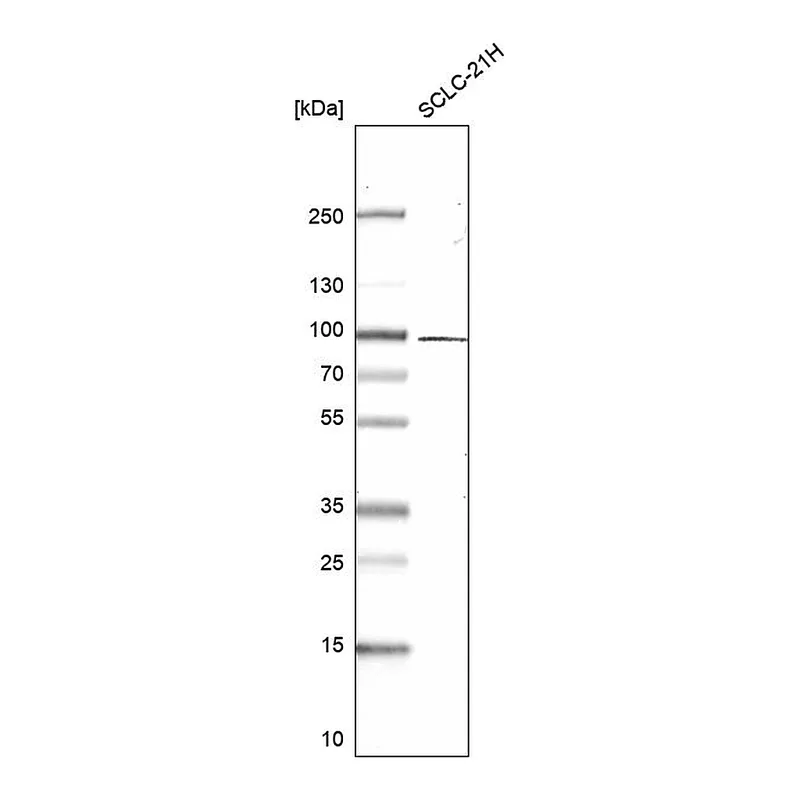 Atlas Antibodies Anti-TGFBRAP1 Antibody