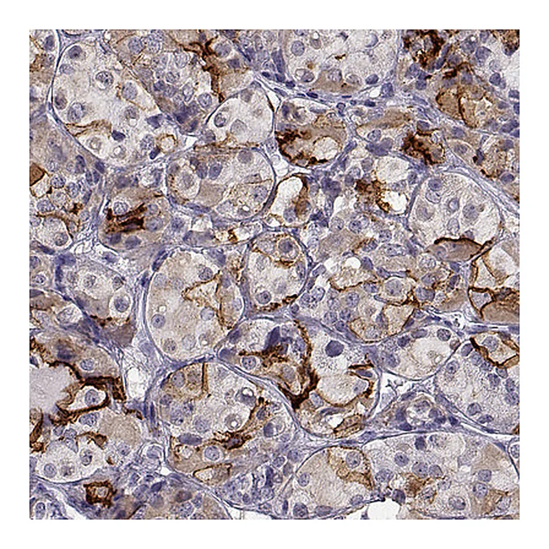 Atlas Antibodies Anti-TGFBR3L Antibody