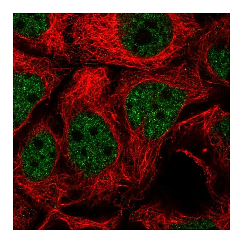 Atlas Antibodies Anti-TGIF2 Antibody