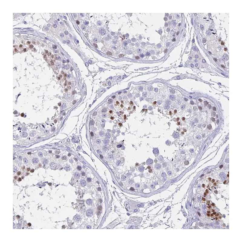 Atlas Antibodies Anti-TGIF2LX Antibody