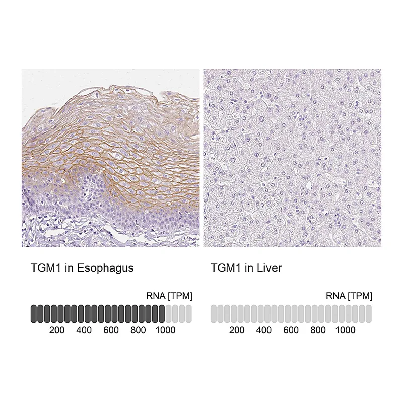 Atlas Antibodies Anti-TGM1 Antibody