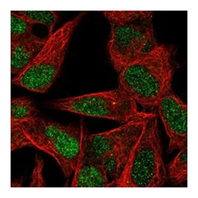 Atlas Antibodies Anti-TGIF2 Antibody