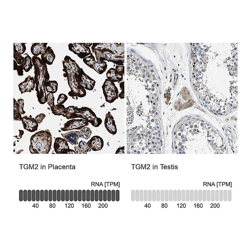 Atlas Antibodies Anti-TGM2 Antibody