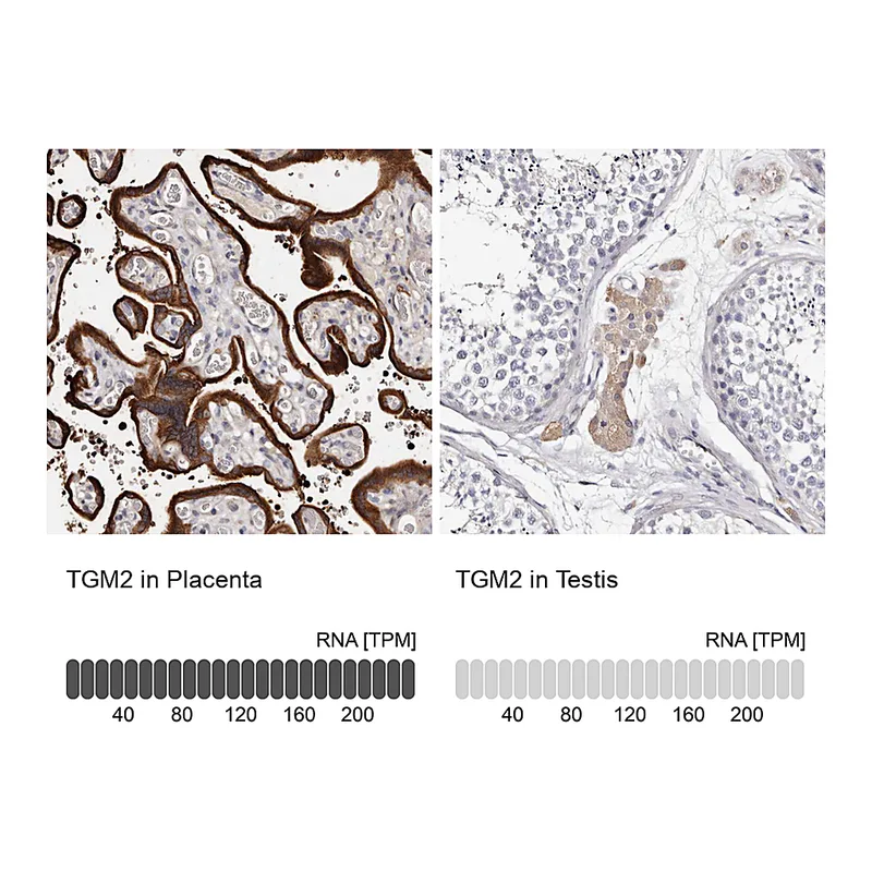 Atlas Antibodies Anti-TGM2 Antibody